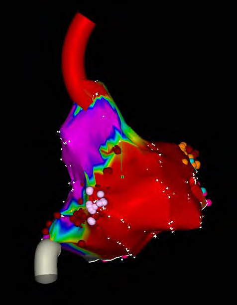 Cardiology